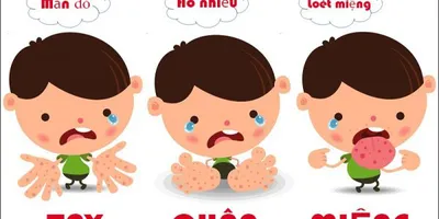 Cách Phòng Bệnh Chân - Tay - Miệng Cho Trẻ Em
