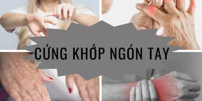 Liệu bạn có đang bị cứng khớp ngón tay khi thức dậy