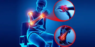 Những Đối Tượng Là “Nạn Nhân” Của Đau Mỏi Cổ Vai Gáy