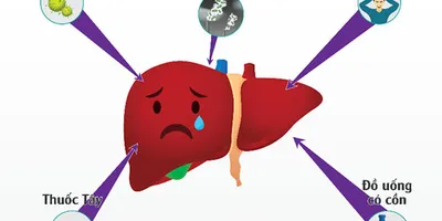 Gan Nhiễm Độc  Và Cách Giải Độc Gan Đơn Giản Tại Nhà