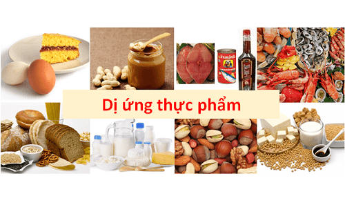Các thực phẩm gây dị ứng