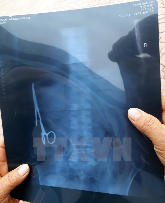 hinh-anh-chup-x-quang Hình ảnh chụp X Quang