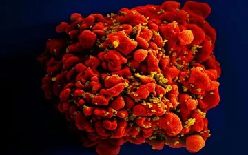 Ca nhiễm HIV thứ 3 trên thế giới được chữa khỏi