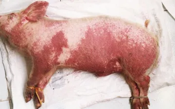 BỆNH LIÊN CẦU KHUẨN - MỐI NGUY HẠI LUÔN RÌNH RẬP