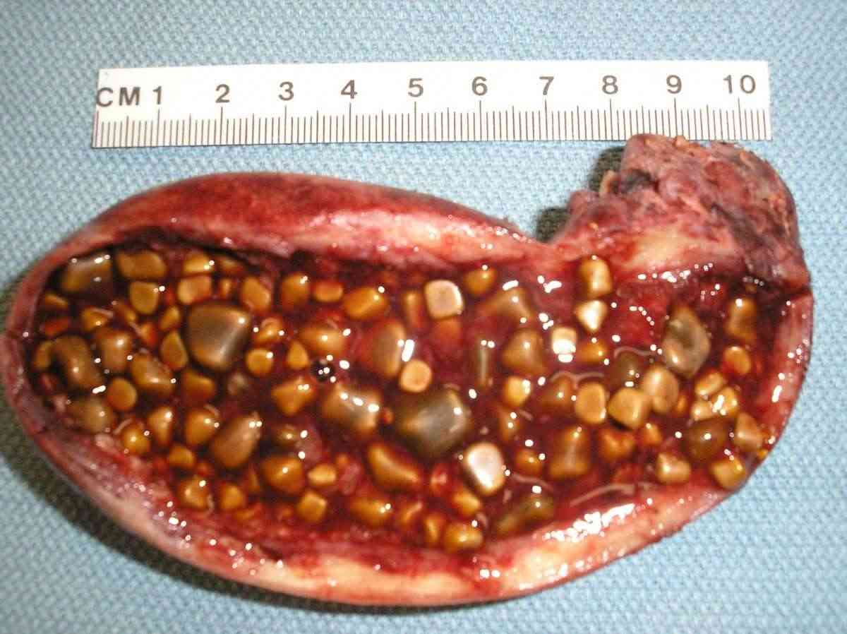 cach chua soi mat hieu qua tai nha