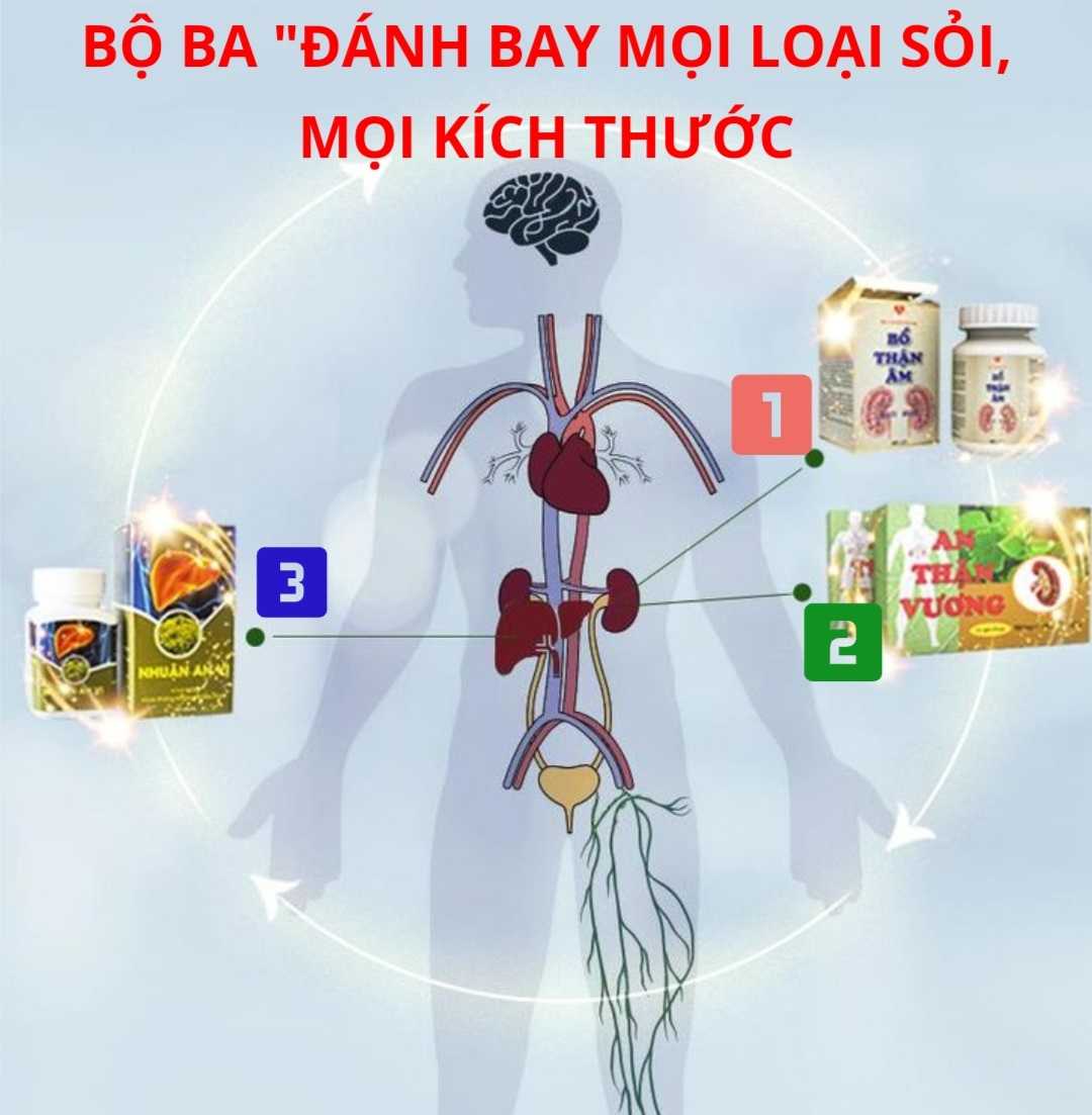 Bộ 3 sản phẩm đánh bay mọi loại sỏi, mọi kích thước