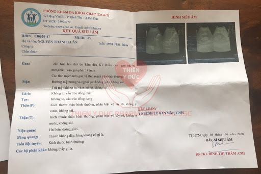 ket qua dieu tri soi anh luan