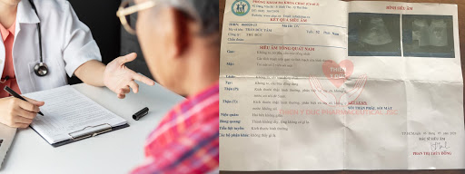 soi 12mm va soi 20mm