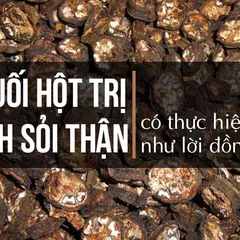 Chuối hột rừng chữa sỏi thận có thực hiệu quả NHƯ LỜI ĐỒN?