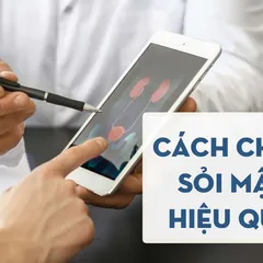 6+ Cách chữa sỏi mật hiệu quả NGAY TẠI NHÀ lương y KHUYÊN DÙNG