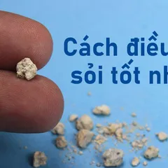 CẦN XEM NGAY cách điều trị sỏi thận tốt nhất tại nhà hoặc ở bệnh viện HIỆU QUẢ, AN TOÀN 2021