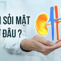 HỎI NHANH ĐÁP GỌN - Tán sỏi mật ở đâu và đã có được câu trả lời uy tín