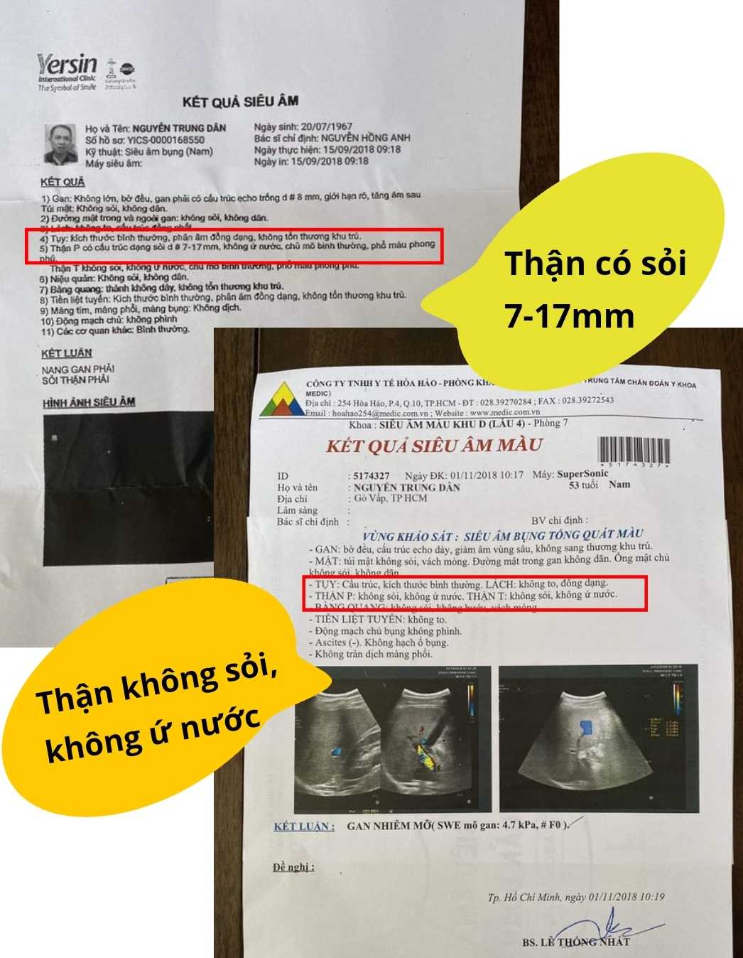 Phiếu xét nghiệm trước và sau khi dùng thuốc An Thận Vương