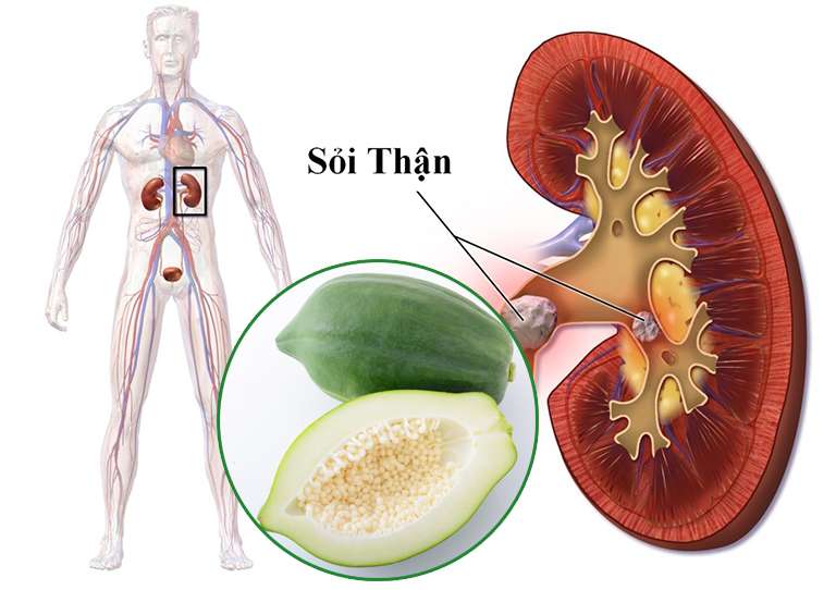 tri soi than tai nha bang du du