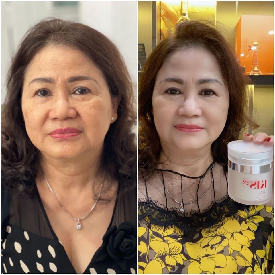 [[Hott]] KEM FACE KIS22 GIÁ BAO NHIÊU - THÀNH PHẦN CÔNG DỤNG THẾ NÀO?