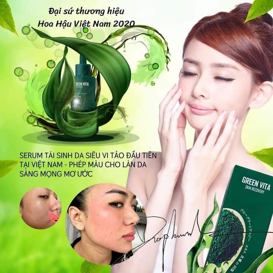 Serum Green Vita - Trị Nám Sáng Da
