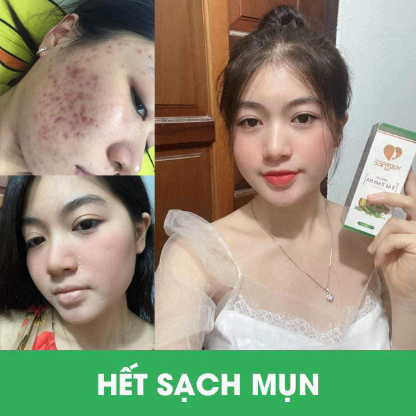 SERUM TÁI TẠO DA YODY WHITE PHƯƠNG ANH