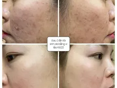 SERUM TÁI TẠO DA SIÊU VI TẢO