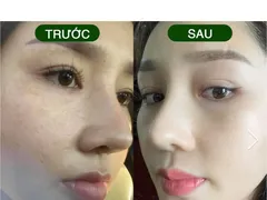 CÔNG DỤNG SERUM TÁI TẠO DA KIS22