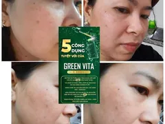SERUM TÁI TẠO DA KIS22 CÓ TỐT KHÔNG