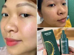 SERUM TÁI SINH DA SIÊU VI TẢO KIS22 GREEN VITA GIÁ BAO NHIÊU