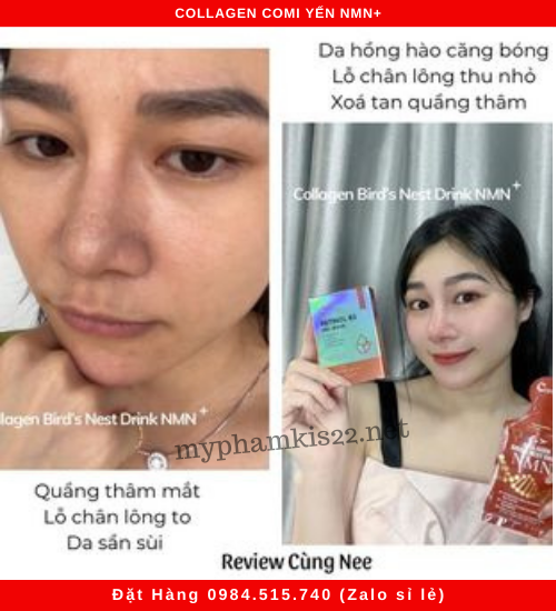 Phản hồi khách dùng collagen comi yến nmn Phản hồi khách dùng collagen comi yến nmn