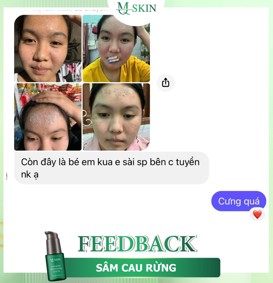 Da khách dùng tái tạo da sâm cau rừng mq skin Da khách dùng tái tạo da sâm cau rừng mq skin