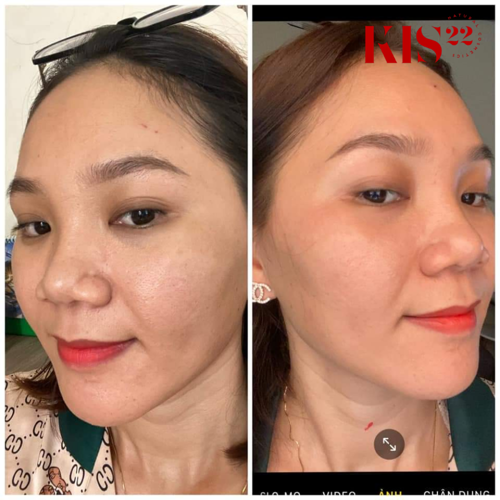 Hình khách sử dụng serum tái tạo da vi tảo kis22 Hình khách sử dụng serum tái tạo da vi tảo kis22