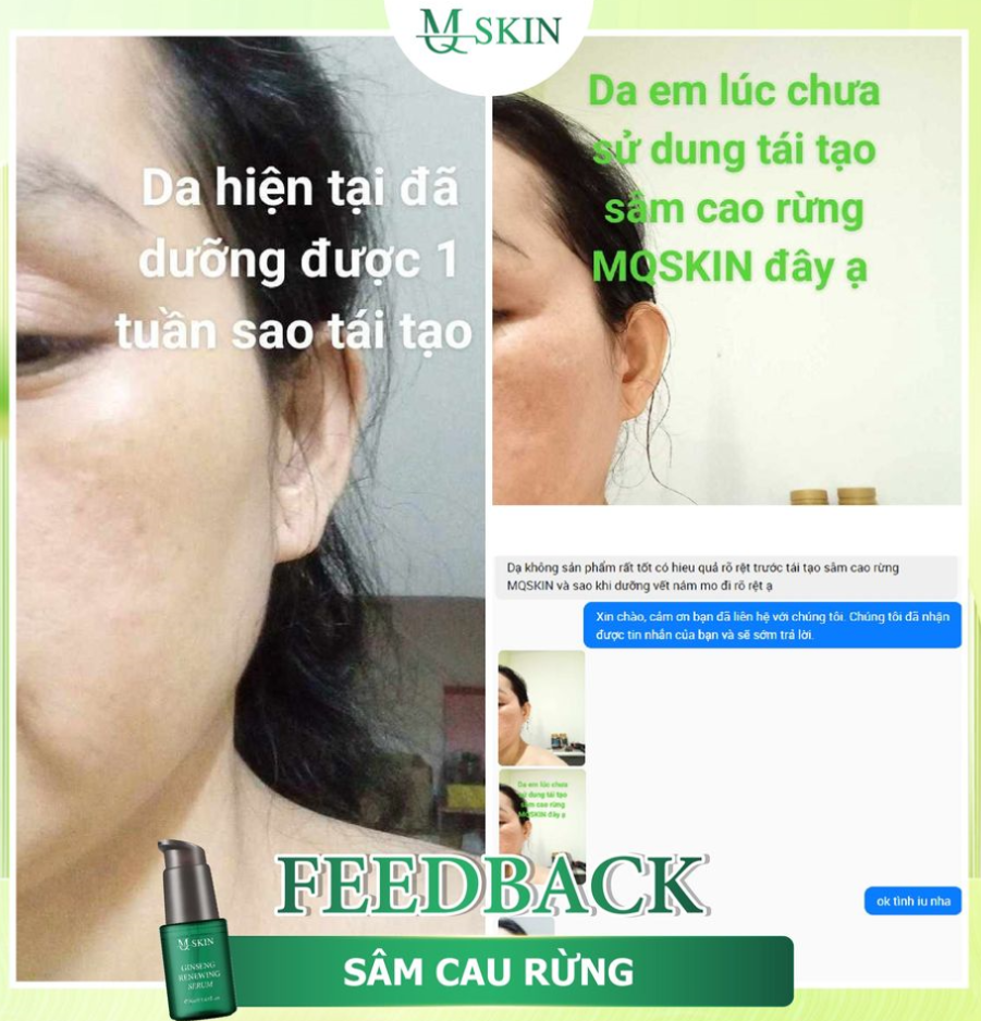 Khách dùng serum tái tạo da sâm cau rừng mq skin Khách dùng serum tái tạo da sâm cau rừng mq skin