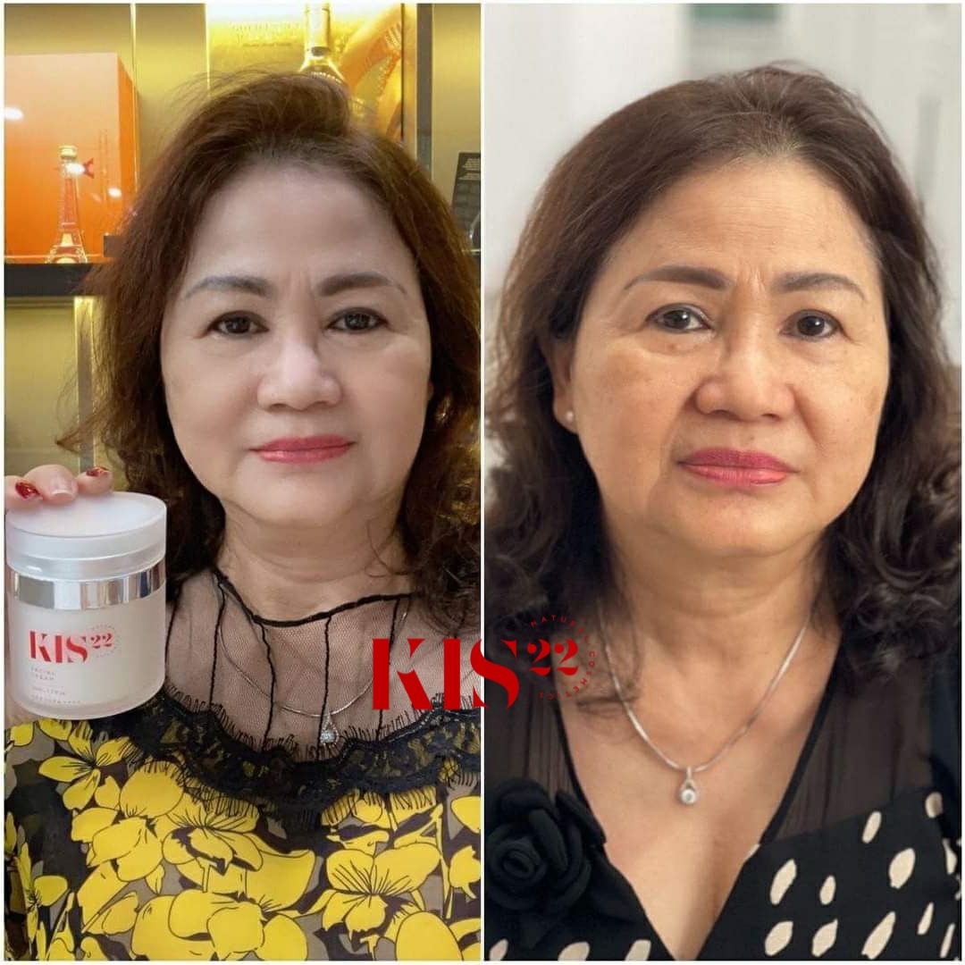 Kem face kis22 Kem face kis22