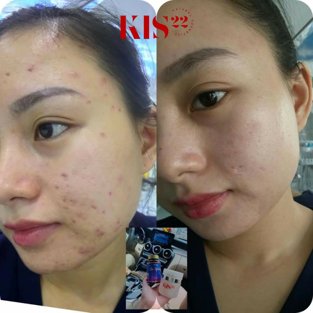 Rewiev kem dưỡng face kis22 Rewiev kem dưỡng face kis22