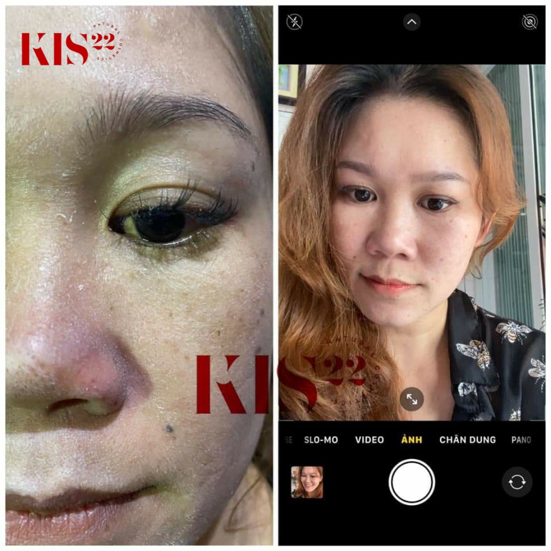 Rewiev kem dưỡng face kis22 Rewiev kem dưỡng face kis22