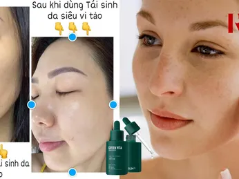 Các Câu Hỏi Thường Gặp Khi Sử Dụng Serum Tái Sinh Da KIS22