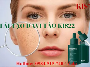 Mua serum tái tạo da kis22 chính hãng ở đâu