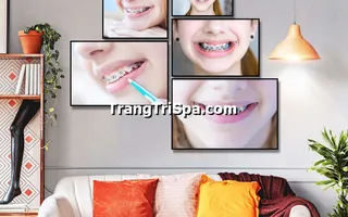 Mẫu Tranh Treo Tường Trang Trí Phòng Khám Nha Khoa Đầy Tính Nghệ Thuật 