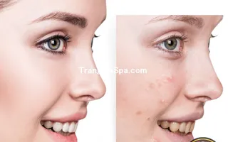 Tổng Hợp Tranh Treo Tường, Dán Tường Và Dán Kính Tiệm Spa Chăm Sóc Da - Body Thịnh Hành Nhất Hiện Nay