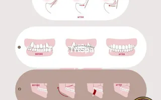 Trang Trí Tiệm Spa - Thẩm Mỹ Viện Bằng Tranh Treo Tường, Dán Tường Và Dán Kính Thịnh Hành Nhất Hiện Nay 