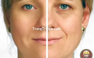 Trang Trí Tiệm Spa - Thẩm Mỹ Viện Bằng Tranh Treo Tường, Dán Tường Và Dán Kính Thịnh Hành Nhất Hiện Nay 