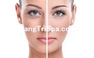 Trang Trí Tiệm Spa - Thẩm Mỹ Viện Bằng Tranh Treo Tường, Dán Tường Và Dán Kính Thịnh Hành Nhất Hiện Nay 