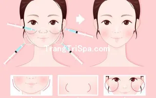 Trang Trí Tiệm Spa - Thẩm Mỹ Viện Bằng Tranh Treo Tường, Dán Tường Và Dán Kính Thịnh Hành Nhất Hiện Nay 