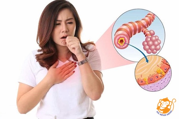 Công dụng của yến sào với người viêm phế quản cấp Công dụng của yến sào với người viêm phế quản cấp