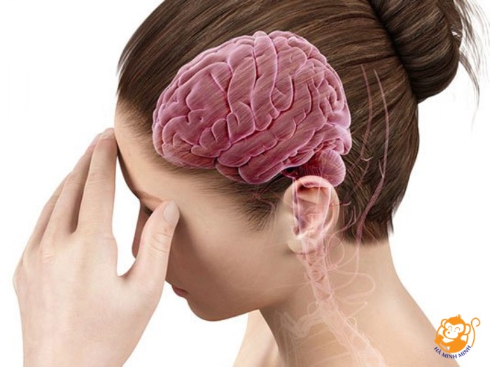 nhồi máu não nhồi máu não