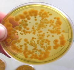 Cấy khuẩn trên đĩa thạch Cấy khuẩn trên đĩa thạch