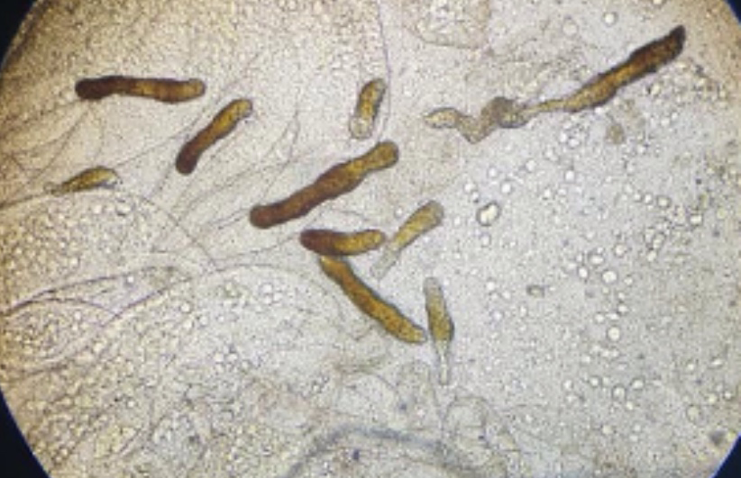 ký sinh trong ruột tôm