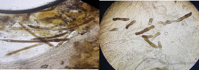 Gegarine trong ruột tôm và Vermiform trong gan tôm Gegarine trong ruột tôm và Vermiform trong gan tôm