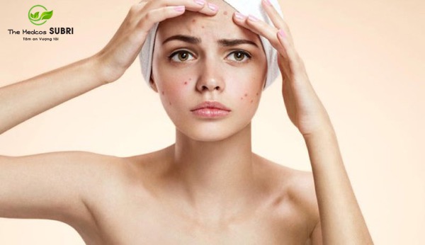 cách sử dụng viên uống thảo dược Codobye hiệu quả cách sử dụng viên uống thảo dược Codobye hiệu quả