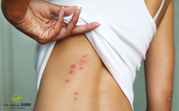 Dùng Nacurgo Gel trong bao lâu có tác dụng Dùng Nacurgo Gel trong bao lâu có tác dụng