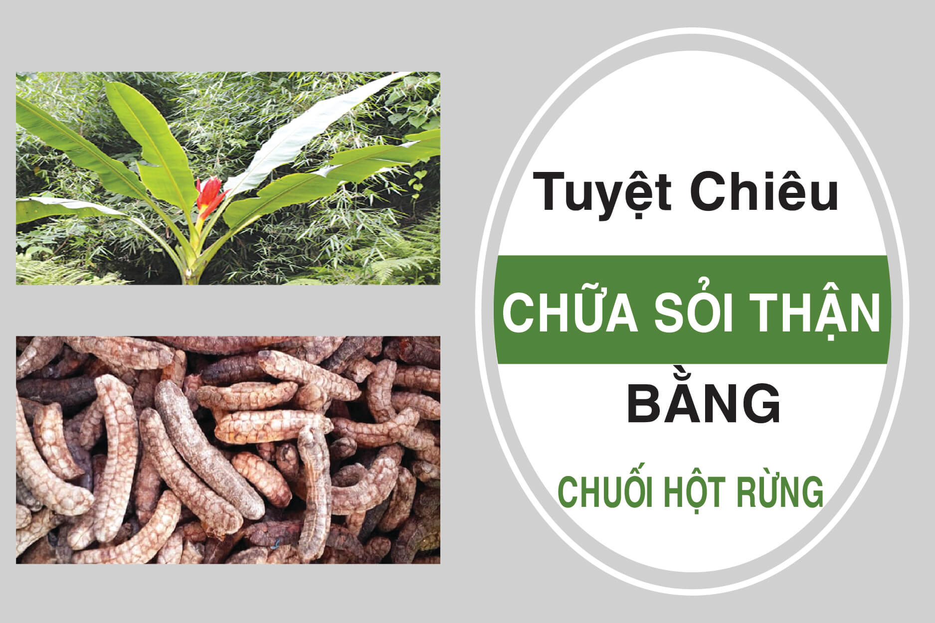 chuối hột rừng chữa sỏi thận chuối hột rừng chữa sỏi thận