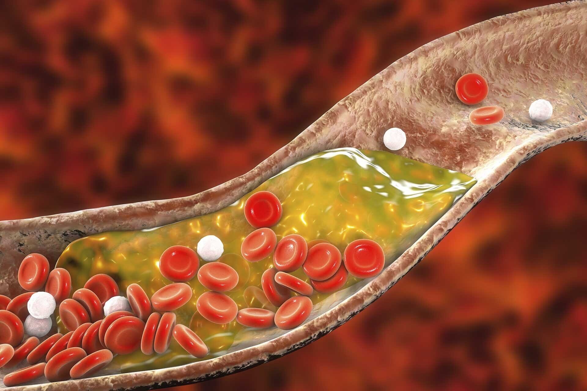 Cholesterol là gì? Có hại cho sức khỏe không? Cholesterol là gì? Có hại cho sức khỏe không?