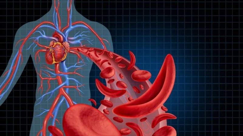 Dầu tía tô hỗ trợ cải thiện sức khỏe tim mạch Dầu tía tô hỗ trợ cải thiện sức khỏe tim mạch